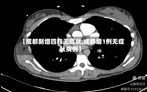 【成都新增四粒无症状,成都增1例无症状病例】