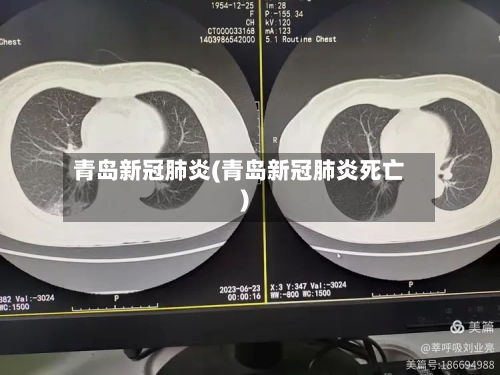 青岛新冠肺炎(青岛新冠肺炎死亡)-第3张图片