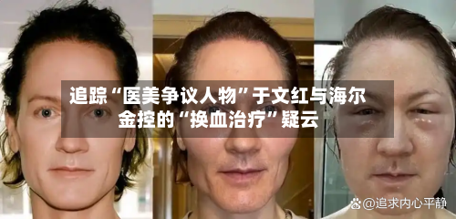 追踪“医美争议人物”于文红与海尔金控的“换血治疗”疑云-第3张图片