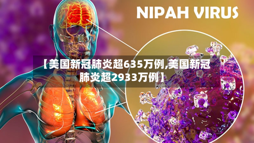 【美国新冠肺炎超635万例,美国新冠肺炎超2933万例】