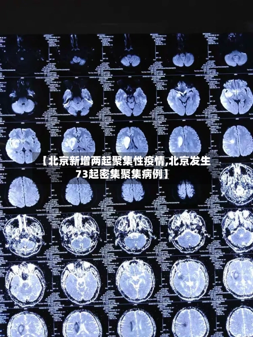【北京新增两起聚集性疫情,北京发生73起密集聚集病例】-第2张图片