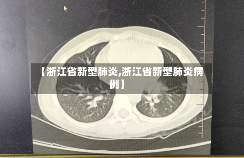 【浙江省新型肺炎,浙江省新型肺炎病例】