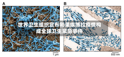 世界卫生组织宣布刚果埃博拉疫情构成全球卫生紧急事件