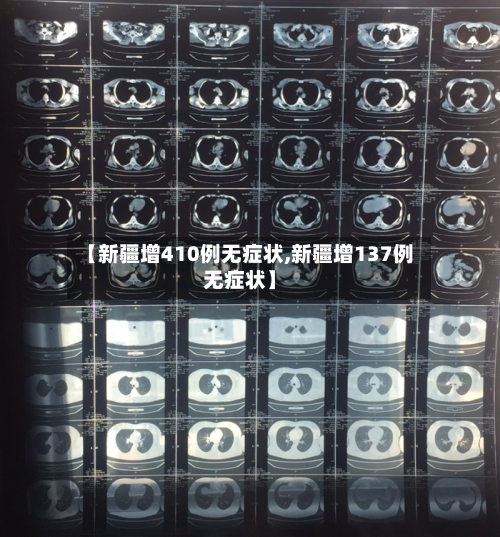 【新疆增410例无症状,新疆增137例无症状】